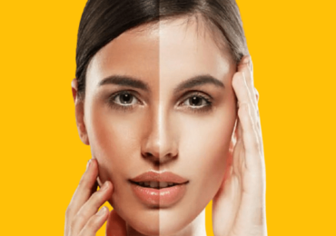 Multani Mitti for Fairness: Achieve Glowing, Even-Toned Skin Naturally